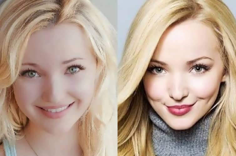 Did Dove Cameron Have A Nose Job?