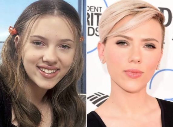 Has Scarlett Johansson Had Plastic Procedures? Before and After