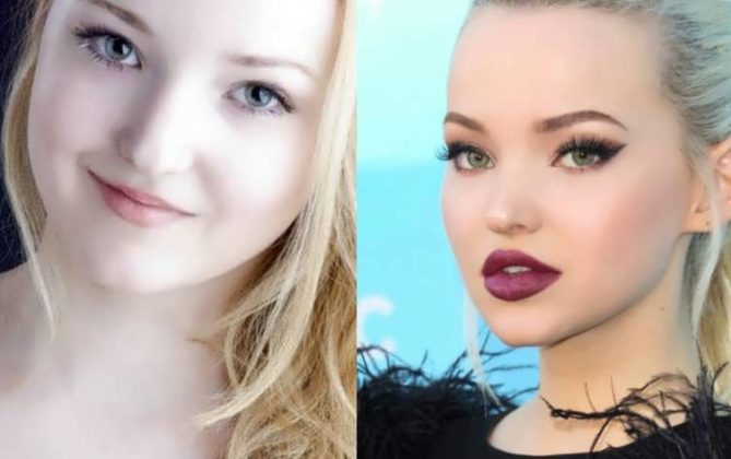 Dove Cameron Plastic Surgery Secret Verge Campus