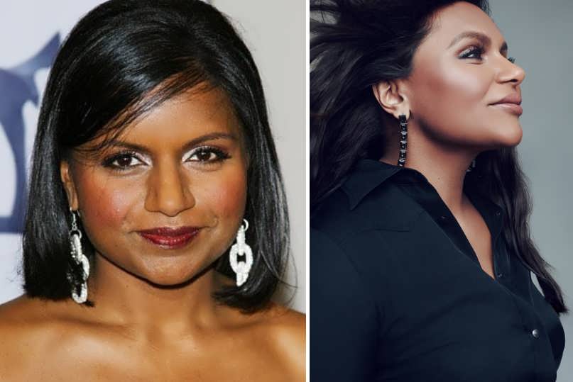 Did Mindy Kaling Have Lip Injections?