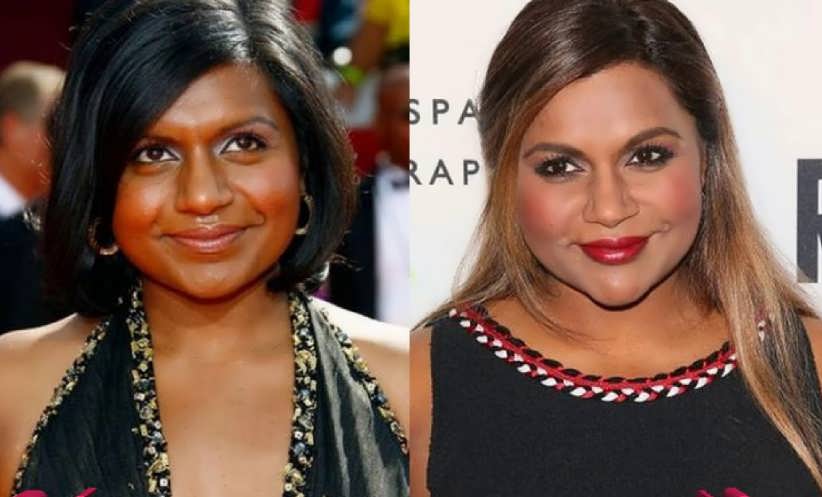 Does Mindy Kaling Have A Nose Job?