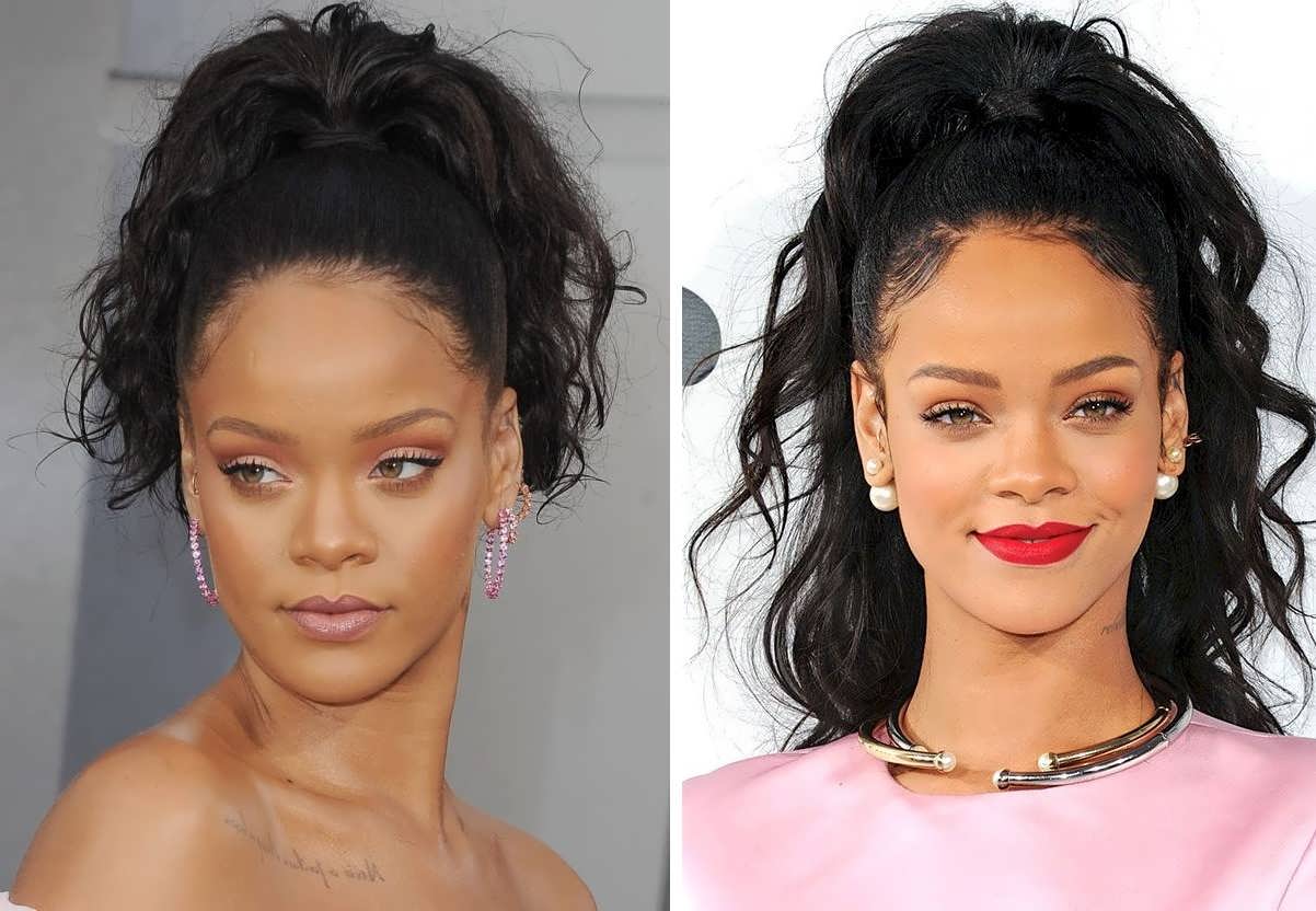 Rihanna's Hairline