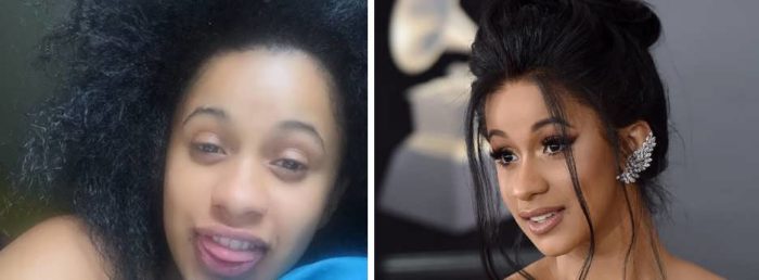 Cardi B Plastic Surgery or Age Transformation - Verge Campus