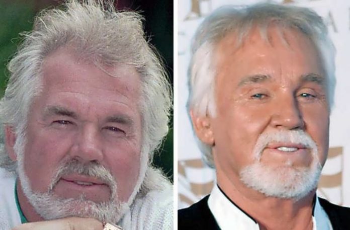 Kenny Rogers Transformation After Plastic Surgery - Verge Campus