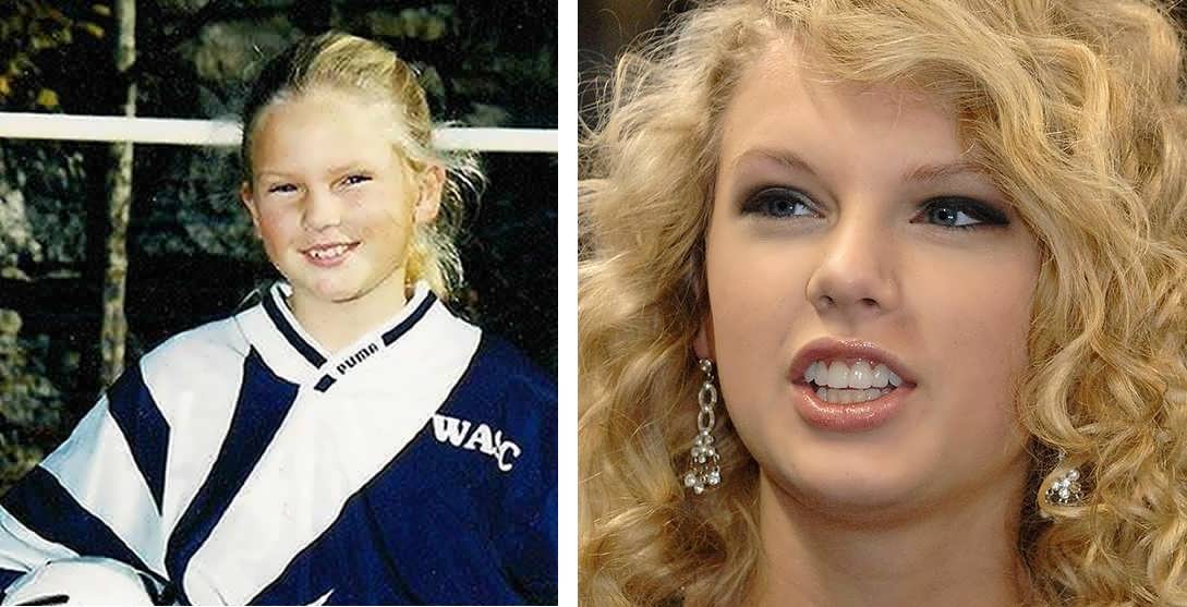Taylor Swift's teeth before and after