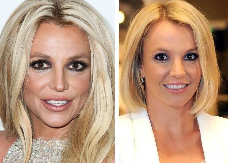 Did Britney Spears Have Facelift & Botox On Her Face