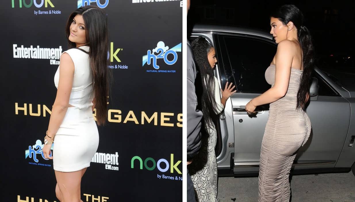 Does Kylie Jenner Have Butt Implants