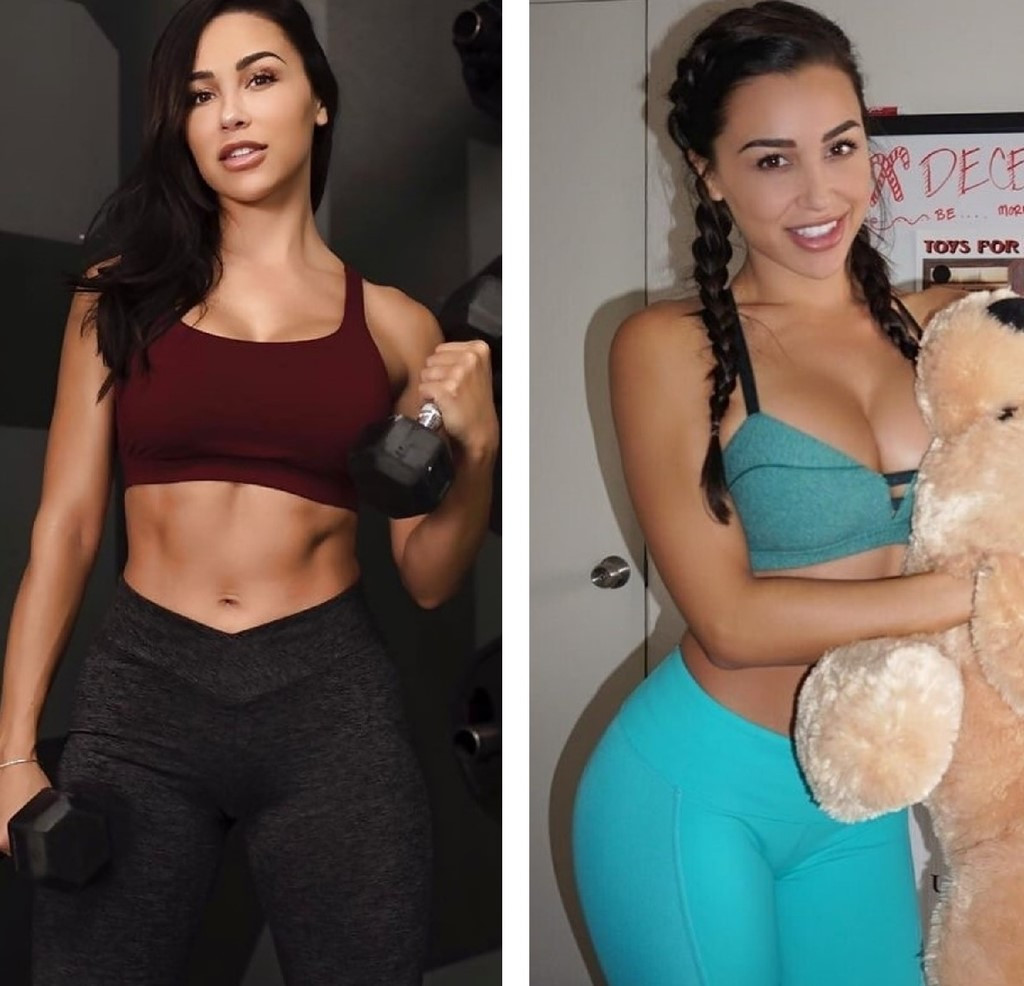 Ana Cheri butt augmentation before and after