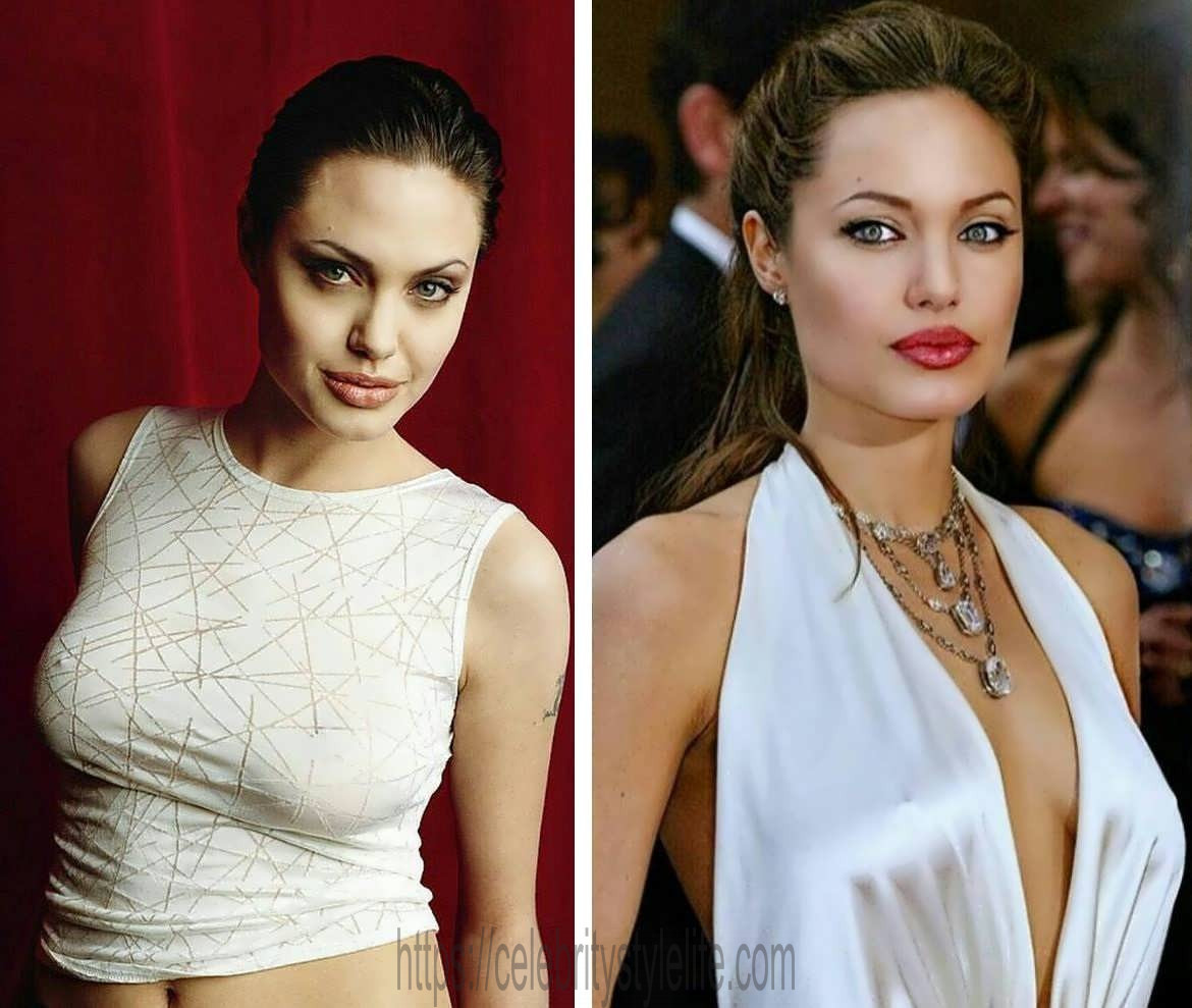 Angelina Jolie boob job before and after