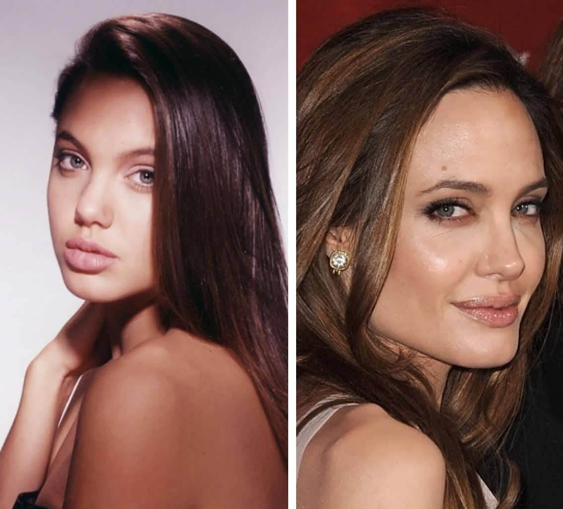 Angelina Jolie rhinoplasty before and after