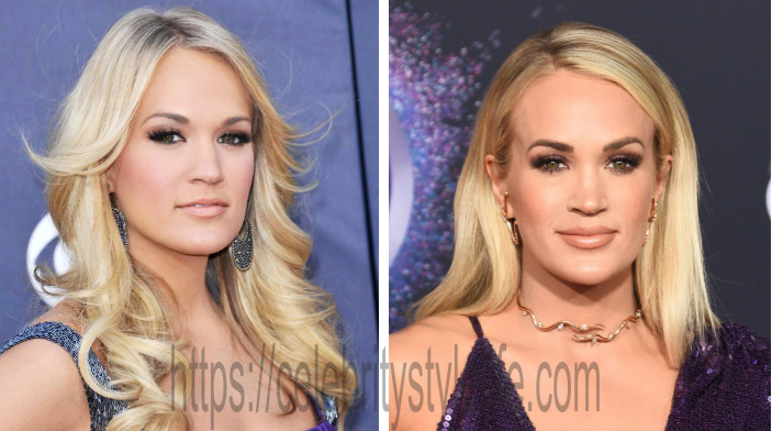 Carrie Underwood lip injections before and after?