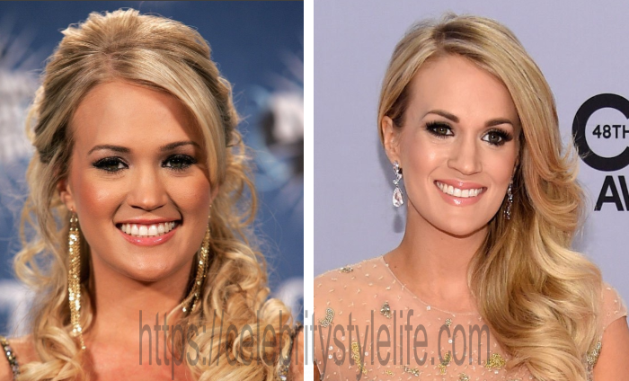 Carrie Underwood teeth before and after