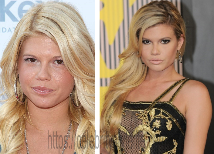 chanel west coast face