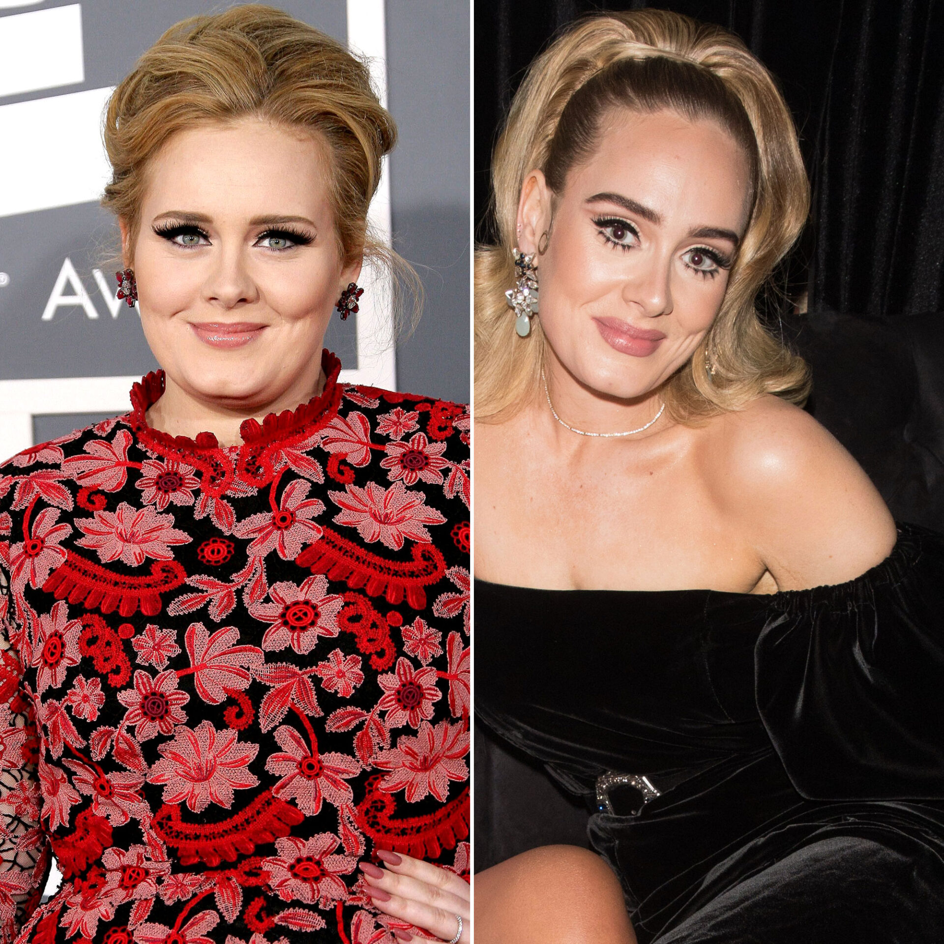 Doctors Claim Adele's Face Changed Due to Plastic Surgery Not Weight