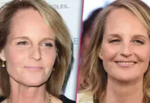 Helen Hunt Erased Her Wrinkles at Age 56: How Did She Do It?