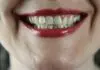 Is It Normal to Bleed When I Floss?