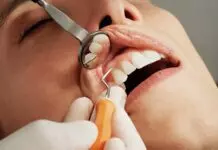10 Signs You Need a Cosmetic Dentist