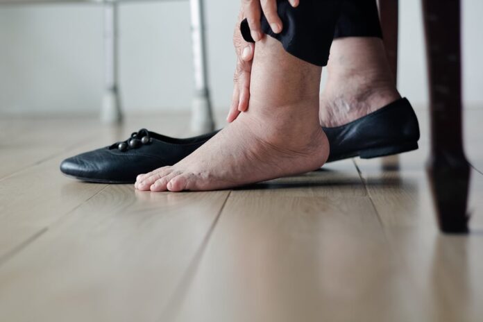 Sock Solutions For Edema: Managing Swelling With Edema Socks - Verge Campus